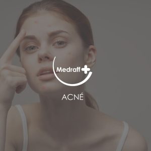 Acne